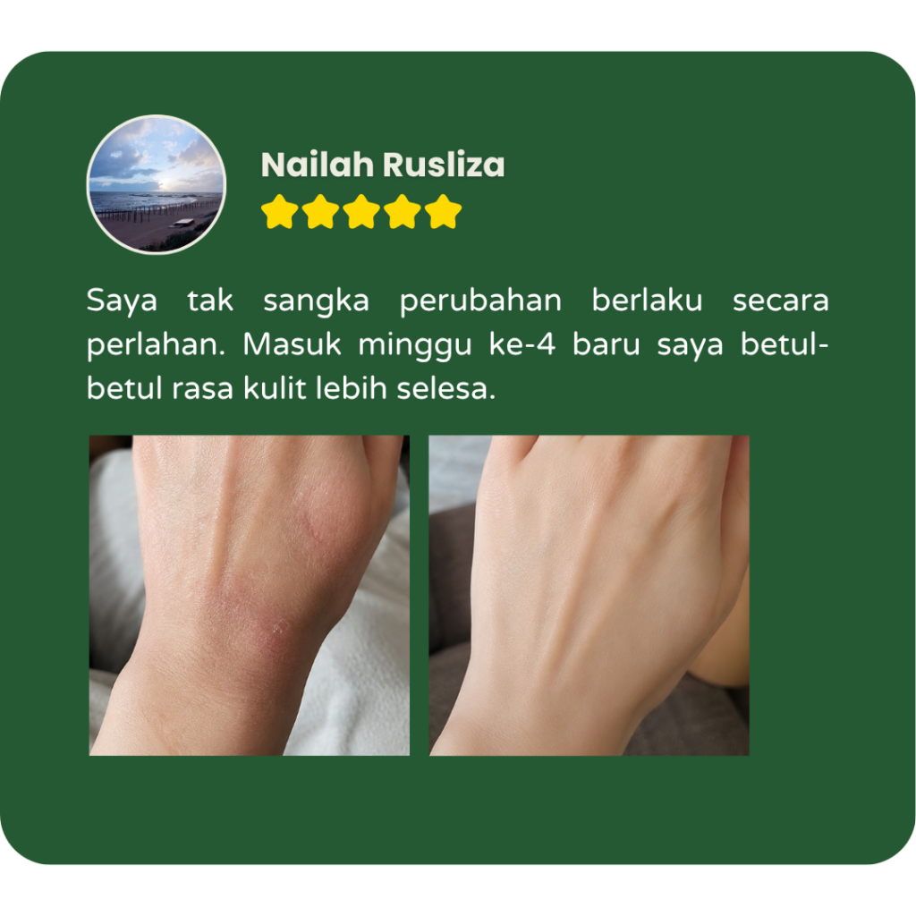 Testimoni pengguna Filogya