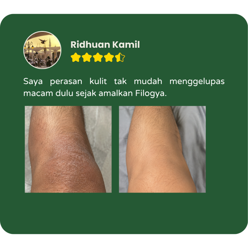 Testimoni pengguna Filogya