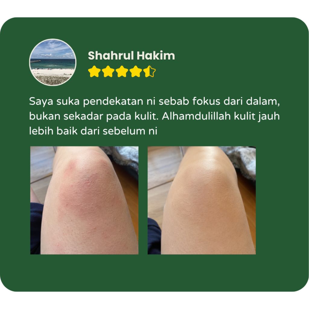 Testimoni pengguna Filogya