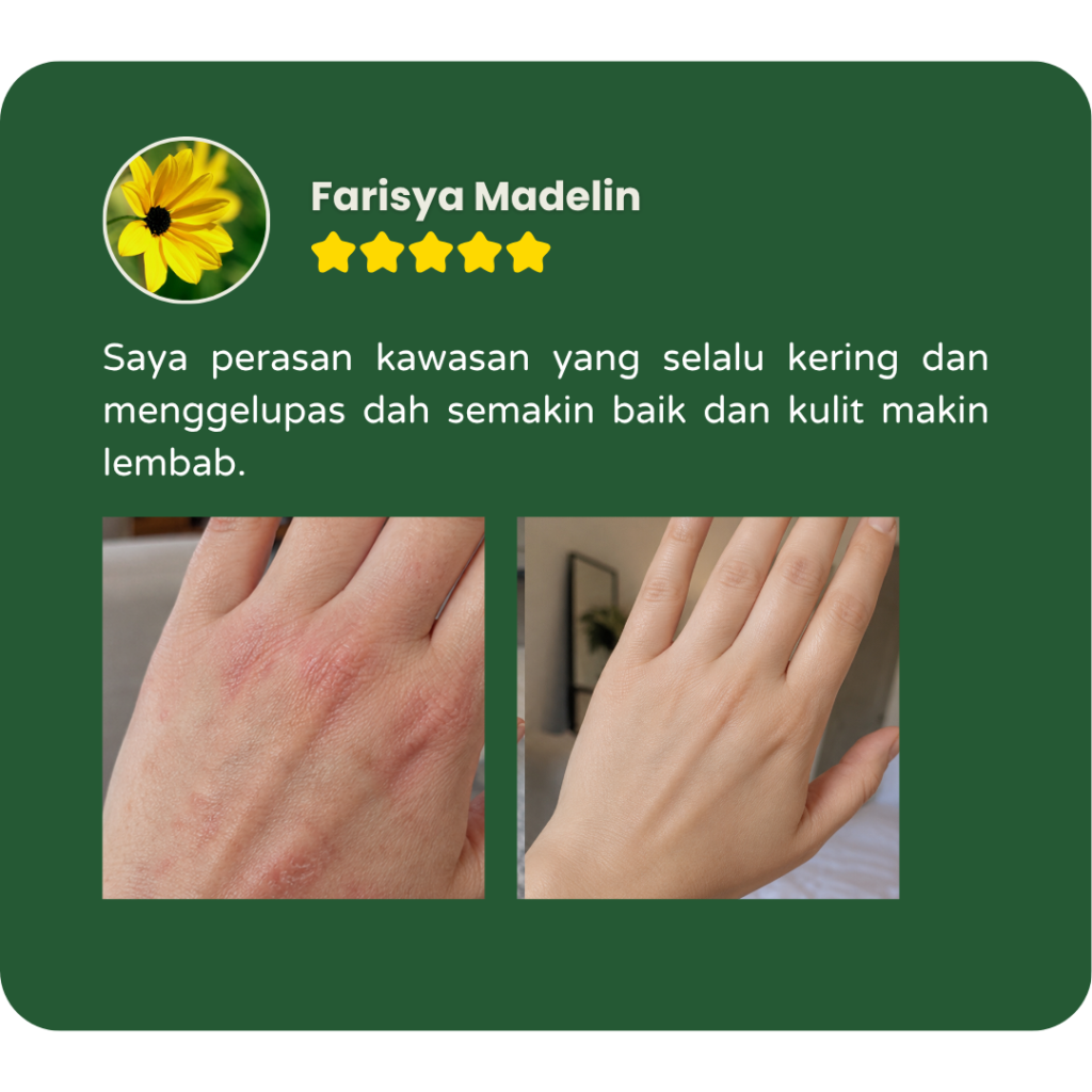 Testimoni pengguna Filogya