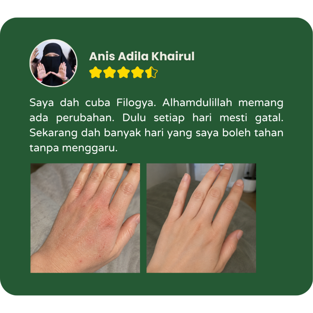 Testimoni pengguna Filogya