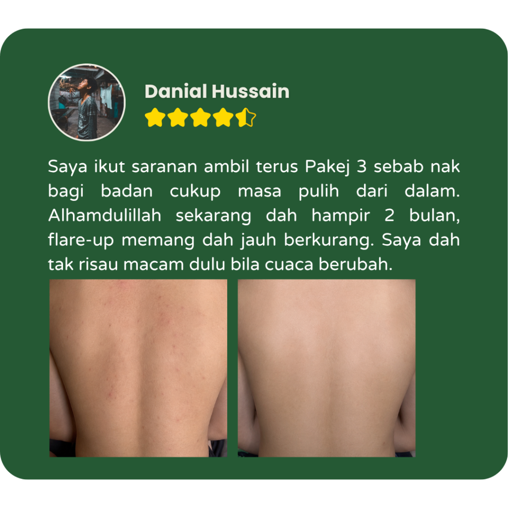Testimoni pengguna Filogya