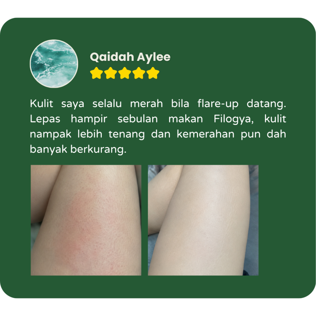 Testimoni pengguna Filogya